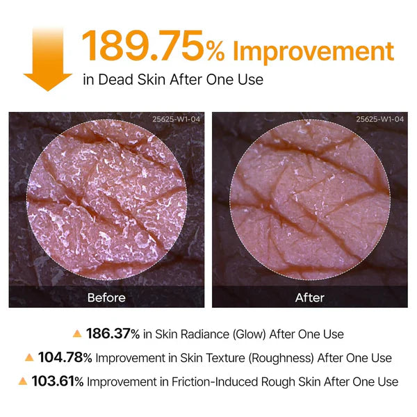 Body Peel Shot Spray